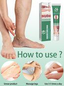 Pomada para varizes Elimina as veias da aranha para aliviar a vasculite flebite Tratamento da dor da aranha Varizes