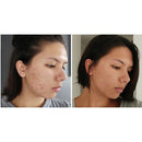 Óleo Puro de Rosa Mosqueta Multinature (Tira de Manchas)-Produto Original