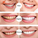 Caneta de clareamento dental Remove placa e tártaro Limpa a boca Escovação dentária Essência MeiYanQiong Escova de dentes Cárie dentária