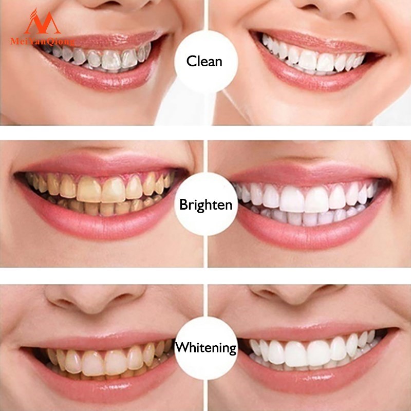 Caneta de clareamento dental Remove placa e tártaro Limpa a boca Escovação dentária Essência MeiYanQiong Escova de dentes Cárie dentária