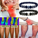 Tratamento de varizes Tornozeleira de Obsidiana Pulseira de Tornozeleira Ajustável Perda de Peso Ímã Terapia Magnética Pulseira de Tornozeleira Feminina Masculina