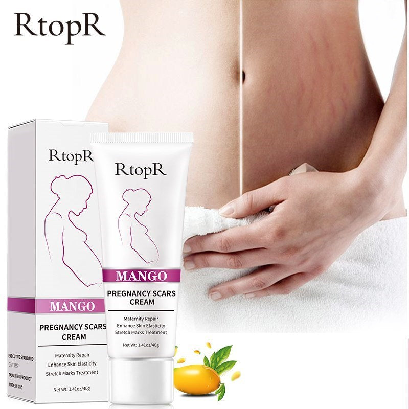 Mango Remover Cicatrizes de Gravidez Creme para Acne Tratamento Estrias Maternidade Reparador Antienvelhecimento Antirrugas Cremes Corporais Refirmantes