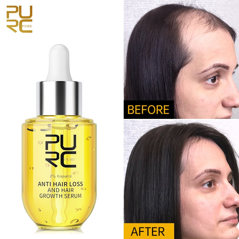 PURC crescimento rápido do cabelo para homens mulheres ruivo Grow Hair Oil Care anti-queda Tratamento do couro cabeludo Essentials Sérum Produtos 50ml