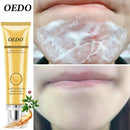 Tratamento de Acne Remoção de Cravo Creme Anti-Acne Controle de Oleosidade Diminuir Poros Cicatriz de Acne Remover Cicatrizes de Rosto Clareamento