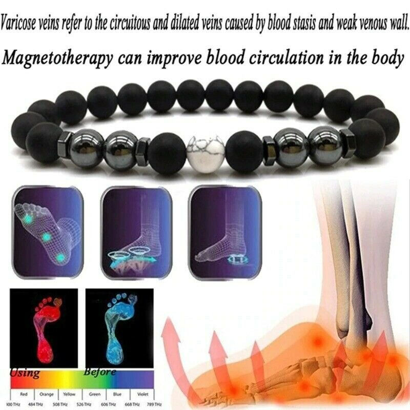 Tratamento de varizes Tornozeleira de Obsidiana Pulseira de Tornozeleira Ajustável Perda de Peso Ímã Terapia Magnética Pulseira de Tornozeleira Feminina Masculina