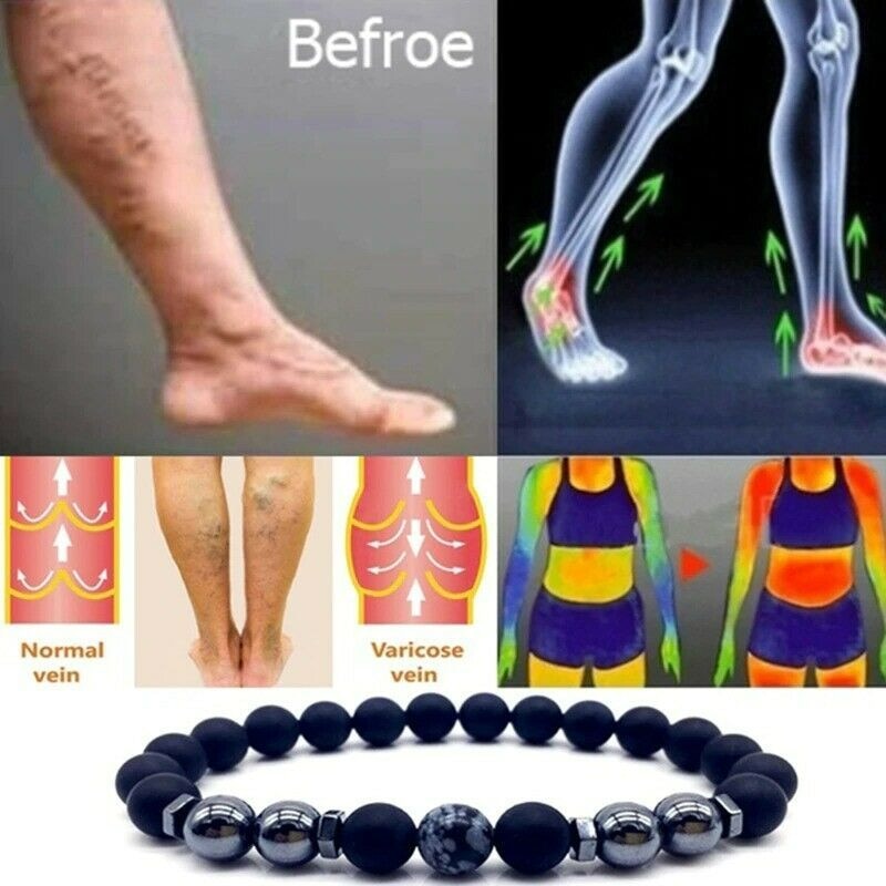 Tratamento de varizes Tornozeleira de Obsidiana Pulseira de Tornozeleira Ajustável Perda de Peso Ímã Terapia Magnética Pulseira de Tornozeleira Feminina Masculina